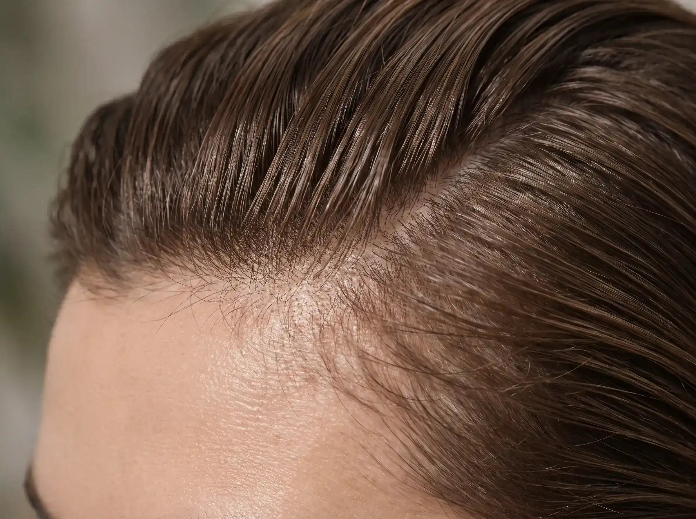 Haare schnell fettig | 5 Tipps für einen länger frischen Ansatz
